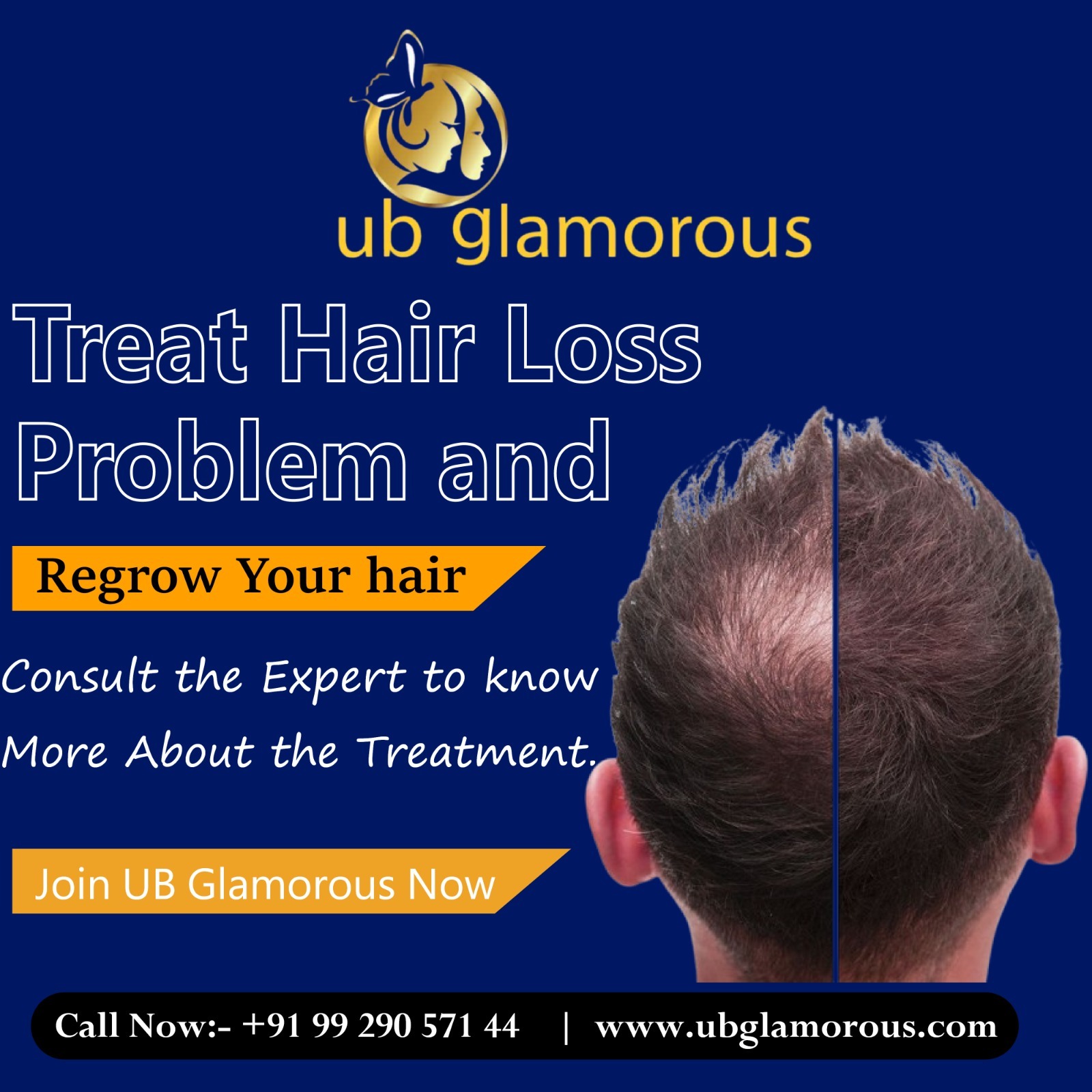  Say Goodbe to Hair Loss & Hello to Fuller Hair!