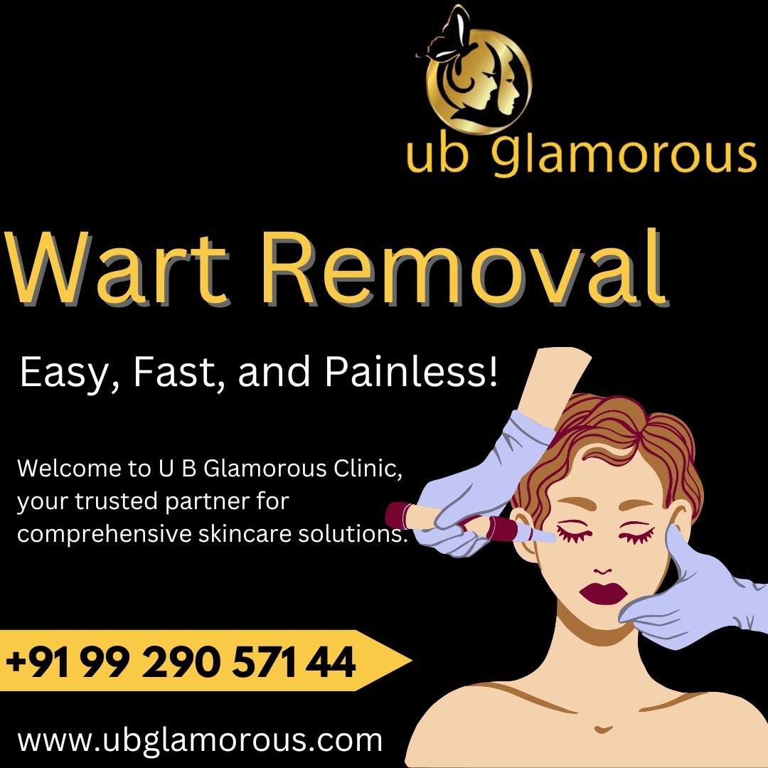 Say Goodbye to Warts – Easy, Fast & Painless