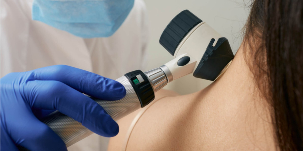 Skin Tag Treatment