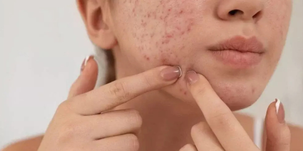 Skin Blemishes Treatment
