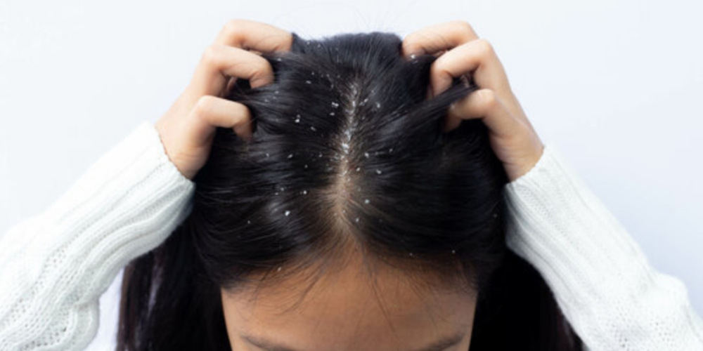 Hair Disease
