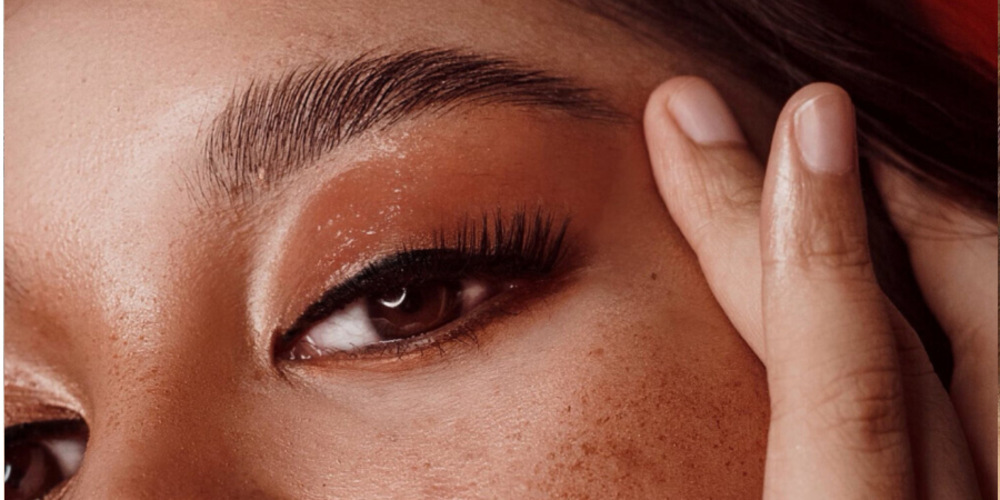 Brow Lift