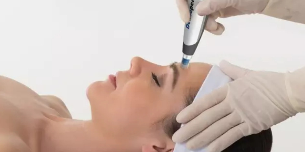 Micro Needling Derma pen 