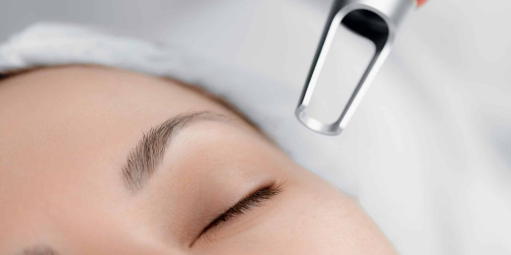 Laser Resurfacing