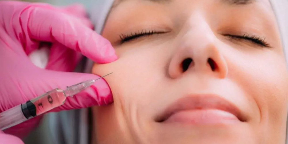 Cheek Augmentation