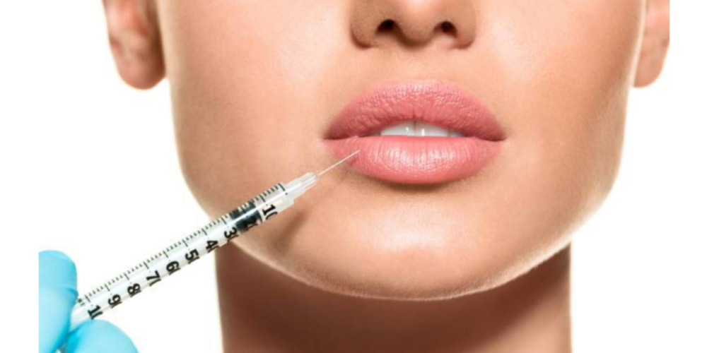 Lip Augmentation