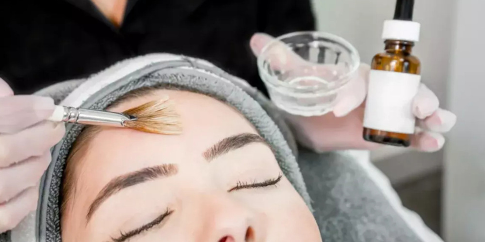 Chemical Peel